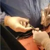 Marcia Chung MD FACS