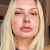 Tacira Colerato